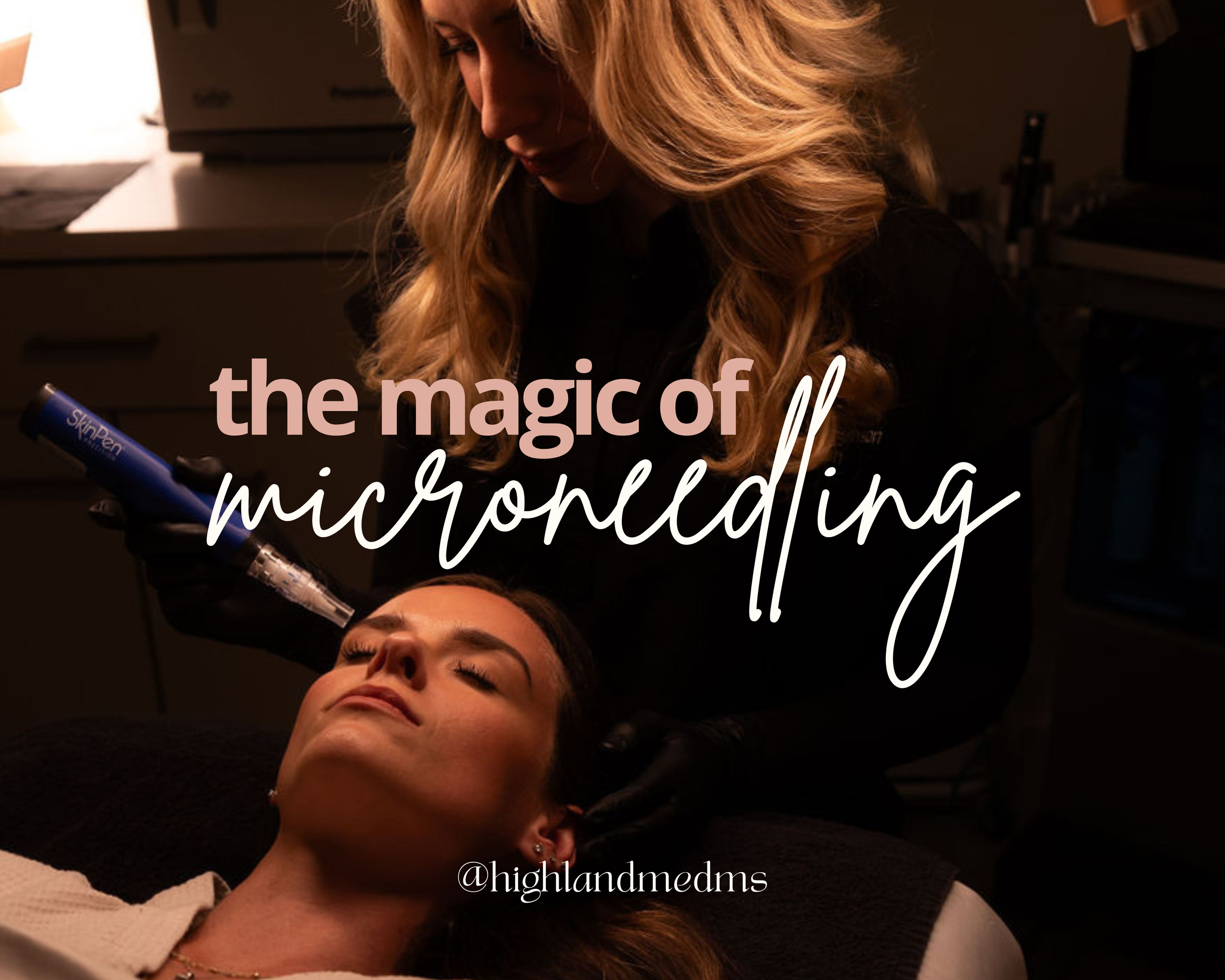 The Magic of Microneedling — Highland Medical & Aesthetics